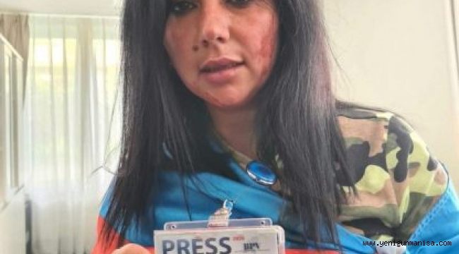 KGK: Brüksel’de Azerbaycanlı Gazeteci Khatira Sardargizi’ye saldırıyı kınıyoruz