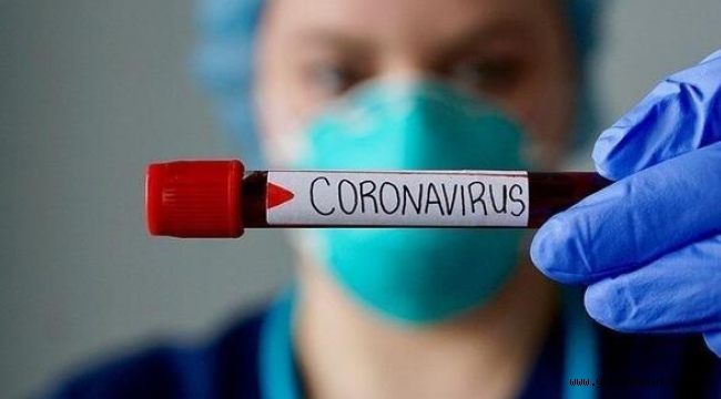 corona virüsün bitiş tarihi  iki yıldan daha kısa sürede olacak