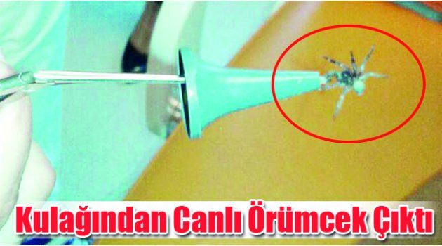 Kulağından Canlı Örümcek Çıktı